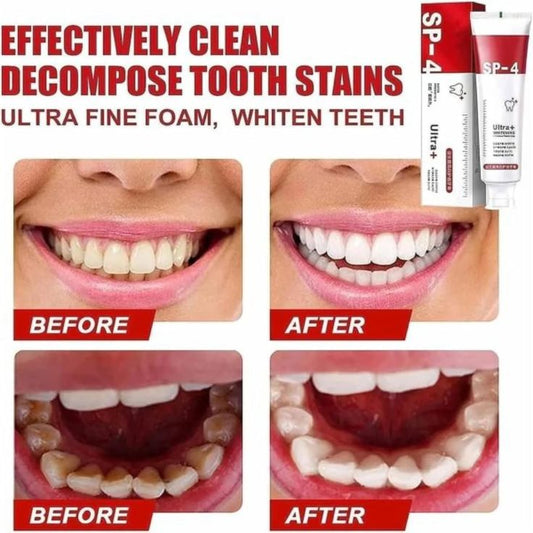 Sp4 Teeth Whitening Toothpaste