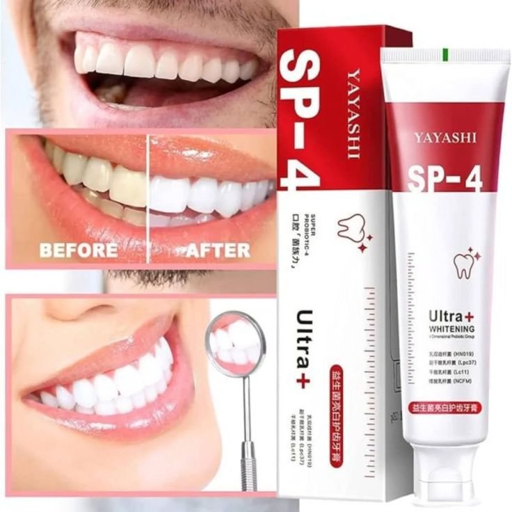 Sp4 Teeth Whitening Toothpaste