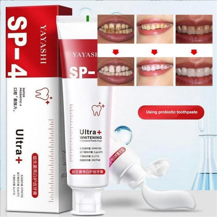 Sp4 Teeth Whitening Toothpaste